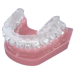 Ormco Digital Bonding